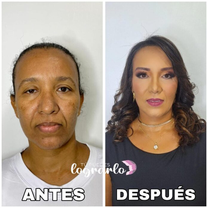 Marialbis no solo recibió procedimientos plásticos y estéticos de alta gama, sino también una atención médica de primer nivel en ginecología, oftalmología, cardiología, odontología y laboratorio